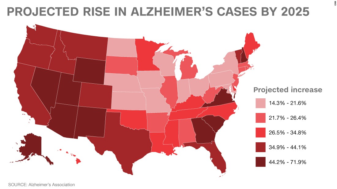 Alzheimers